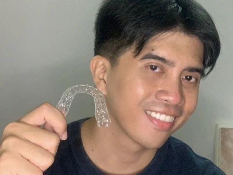 Zenyum Review Invisible Braces Singapore