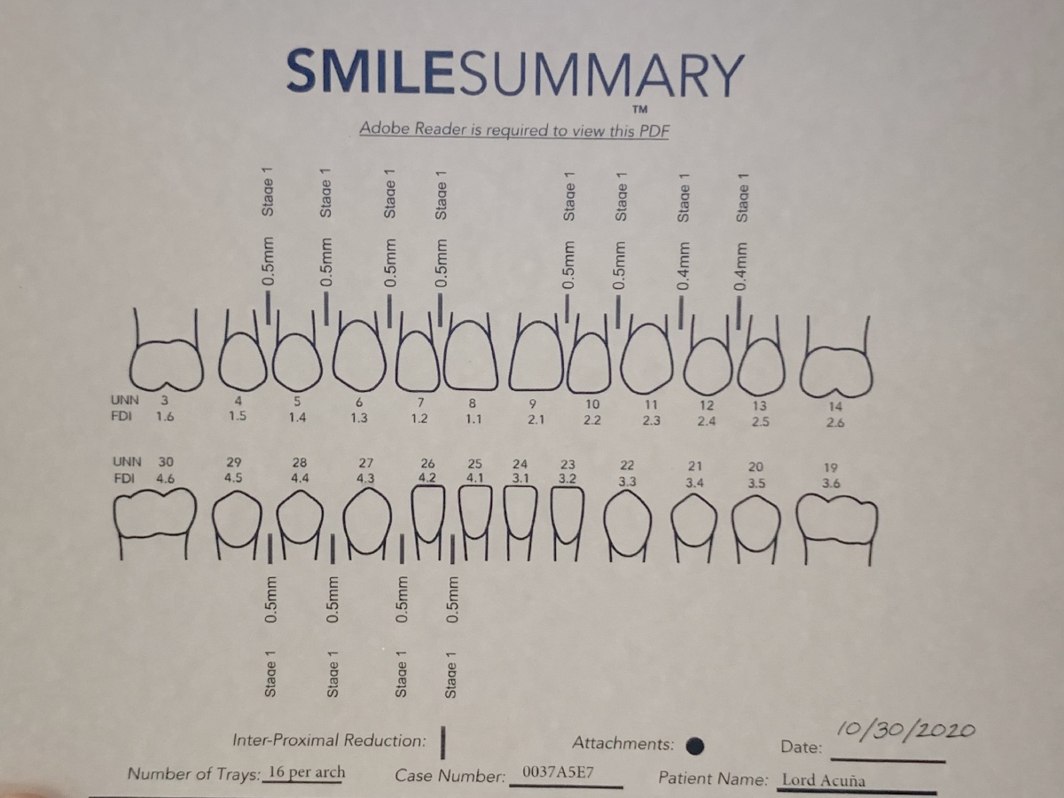 My Zenyum invisible braces experience Let's get it straight Lord Around The World