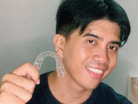 My Zenyum Clear Aligners Experience: Let’s Get It Straight